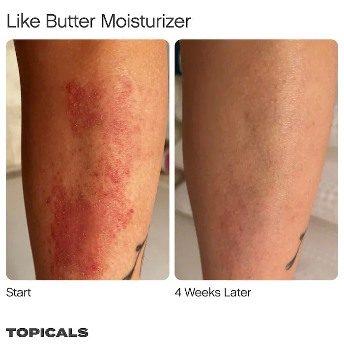 Topicals  Like Butter Moisturizer for Dry, Sensitive & Eczema-Prone Skin