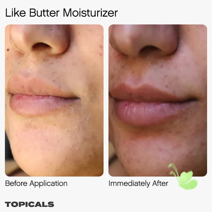 Topicals  Like Butter Moisturizer for Dry, Sensitive & Eczema-Prone Skin