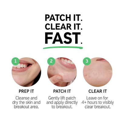 The INKEY List  Hydrocolloid Invisible Pimple Patches + Salicylic Acid
