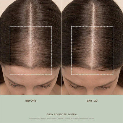 Vegamour  GRO+ Advanced Balancing Shampoo and Conditioner Set for Severe Signs of Thinning