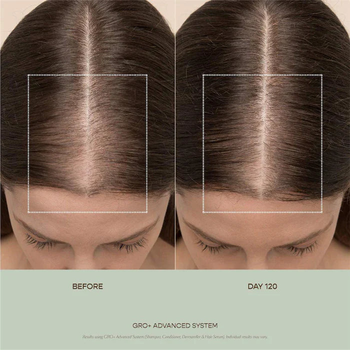 Vegamour  0.25 mm GRO+ Advanced Scalp Dermaroller