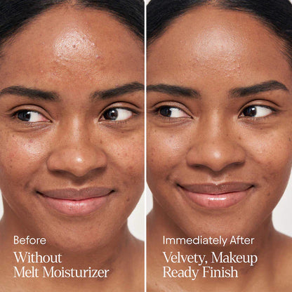ALPYN  Melt Moisturizer for Firming, Plumping & Brightening