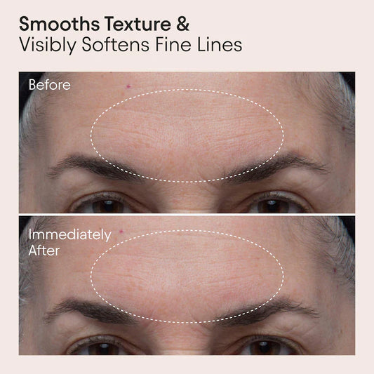 ALPYN  Polishing Peel & Brightening Face Mask with 8 Acids & Huckleberry