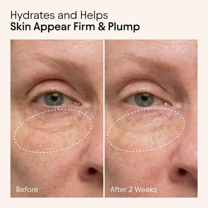 ALPYN  Hydrating Firming Serum with Niacinamide & Nettle