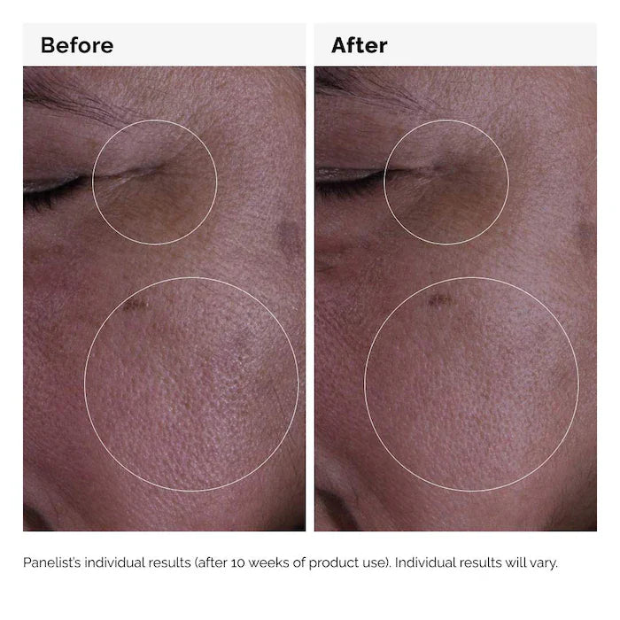 The Ordinary  GF 15% Serum for Visible Skin Repair and Wrinkles