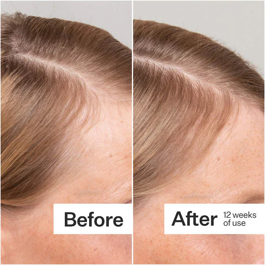 Act+Acre  2% Stem Cell H-2 Grow Complex ™ Scalp Serum For Thicker-Looking Hair