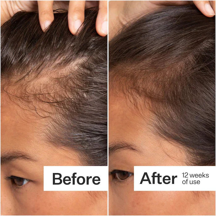 Act+Acre  2% Stem Cell H-2 Grow Complex ™ Scalp Serum For Thicker-Looking Hair
