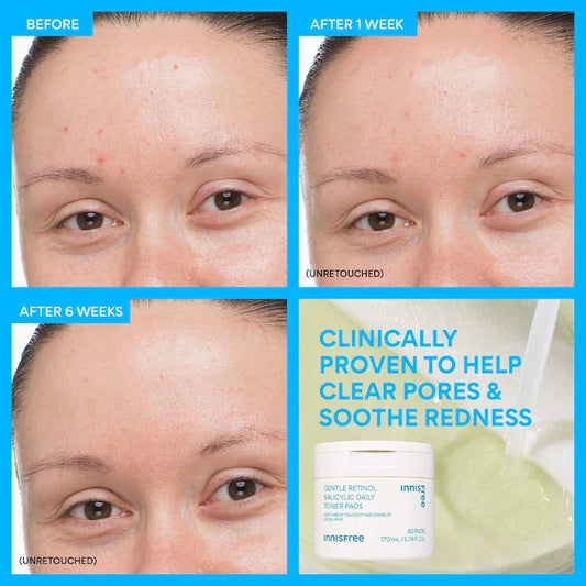 innisfree  Daily Gentle Retinol Salicylic Toner Pads