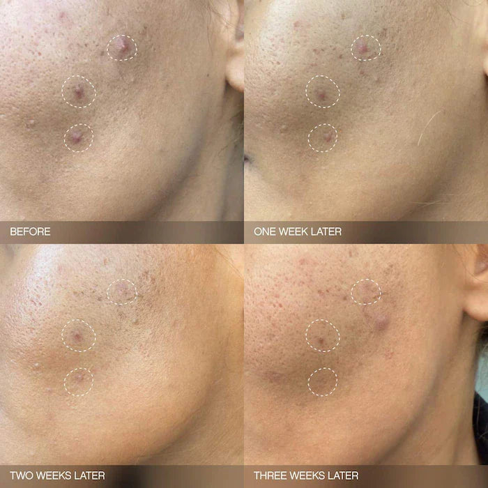 Topicals  Faded Brightening Serum for Dark Spots and Discoloration (UNSCENTED)