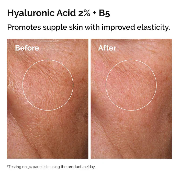 The Ordinary  The Skin Support Set with Niacinamide + Hyaluronic Acid