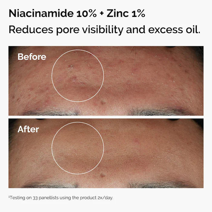 The Ordinary  The Skin Support Set with Niacinamide + Hyaluronic Acid