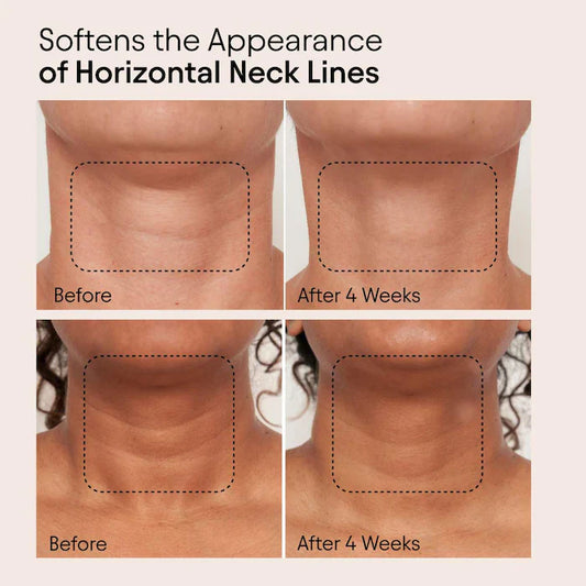 ALPYN  Super Sculpt Serum For Face & Neck with Tri-Peptide Firming Complex