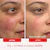 Ultra Repair® Cream Intense Hydration – Face and Body Moisturizer for Skin Repair