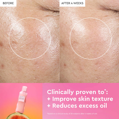 Glow Recipe  Watermelon Glow PHA + BHA Pore-Tight Toner