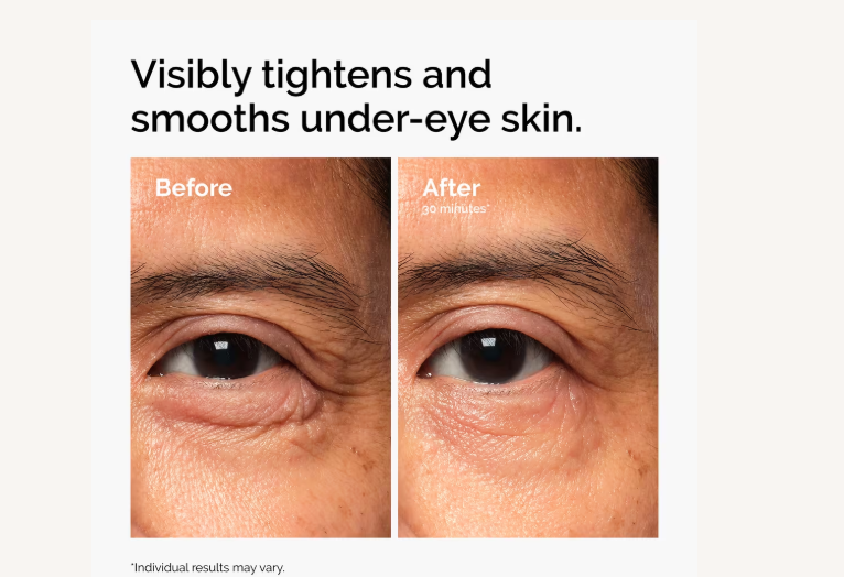 Lacto-PDRN 4% + B9 Eye Cream