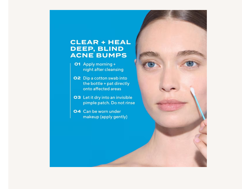 Deep Relief Acne Treatment