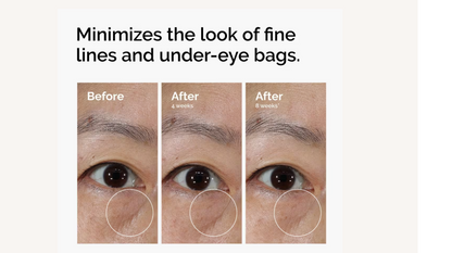 Lacto-PDRN 4% + B9 Eye Cream