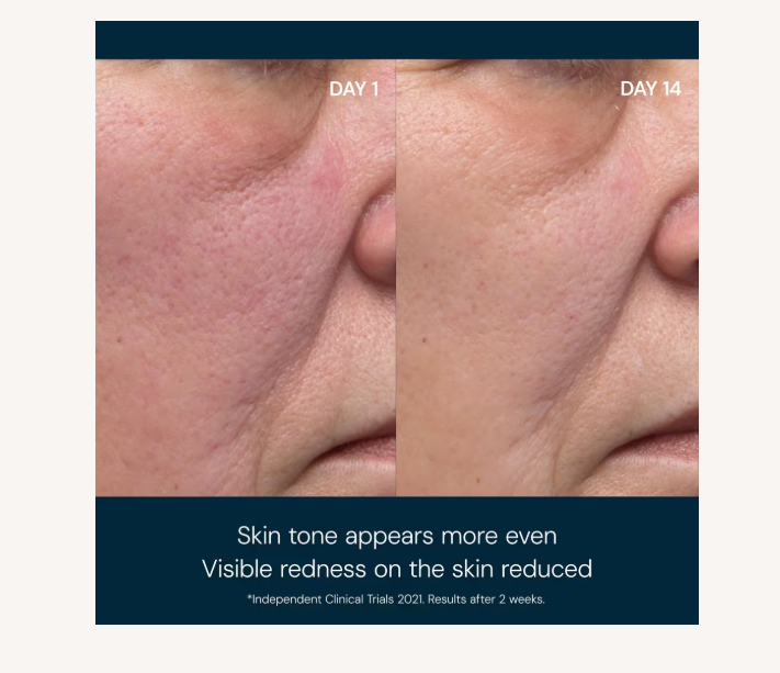 Dynamic Resurfacing Facial Pads