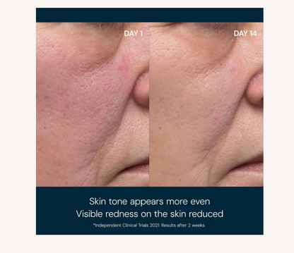 Dynamic Resurfacing Facial Pads
