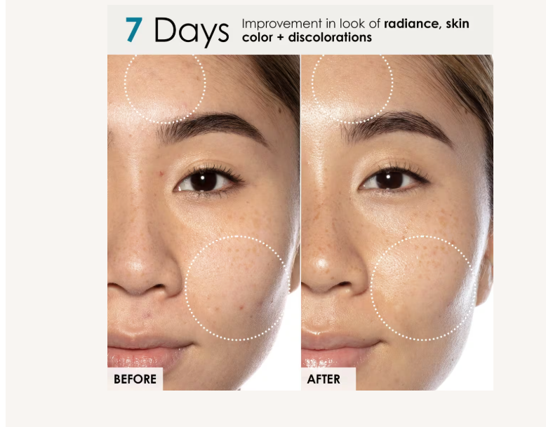 Good Genes All-In-One Lactic Acid Treatment