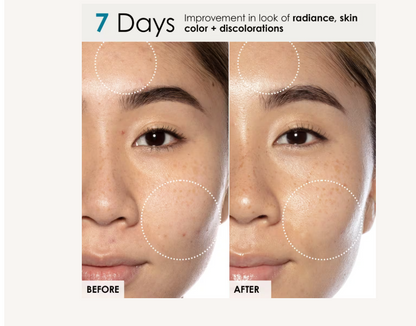 Good Genes All-In-One Lactic Acid Treatment